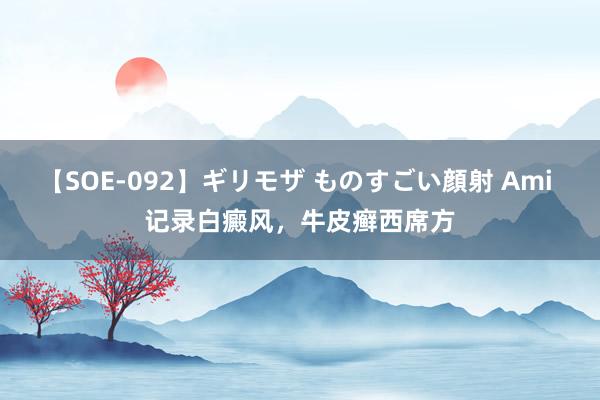 【SOE-092】ギリモザ ものすごい顔射 Ami 记录白癜风，牛皮癣西席方